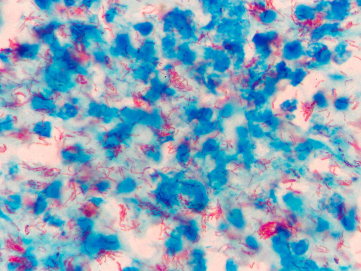 How new data shines a light on infectious disease research
