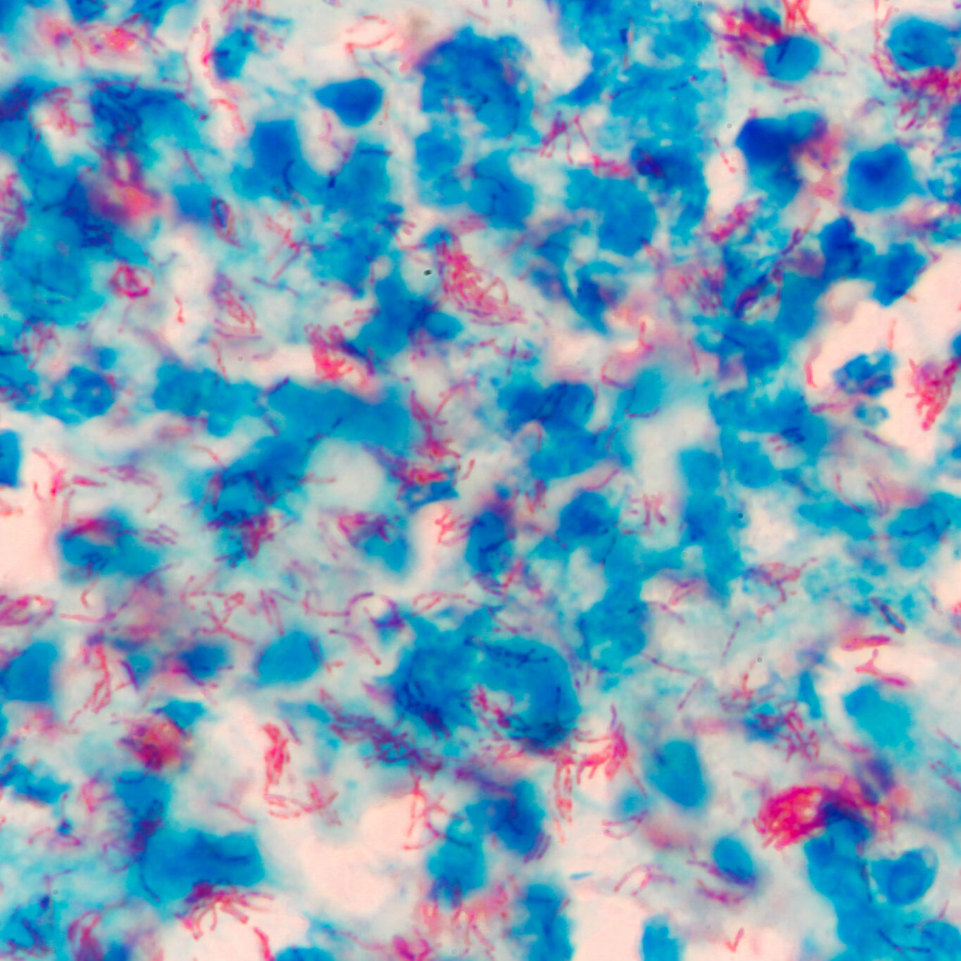 How new data shines a light on infectious disease research